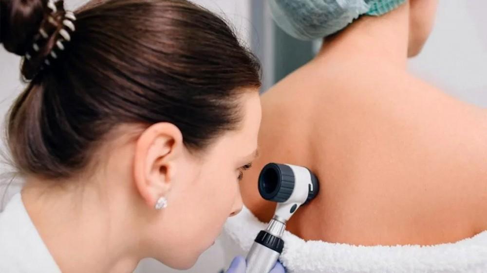 4 Skin Conditions That Should Compel You To See Your Dermatologist Quickly