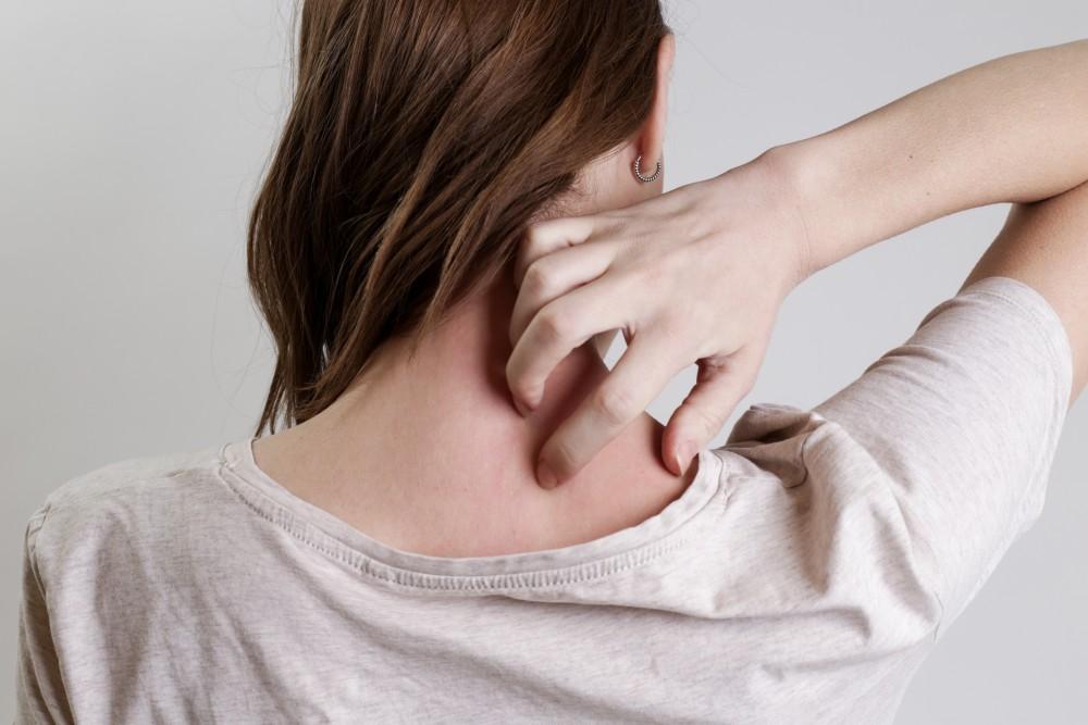 6 Tips for Managing Psoriasis