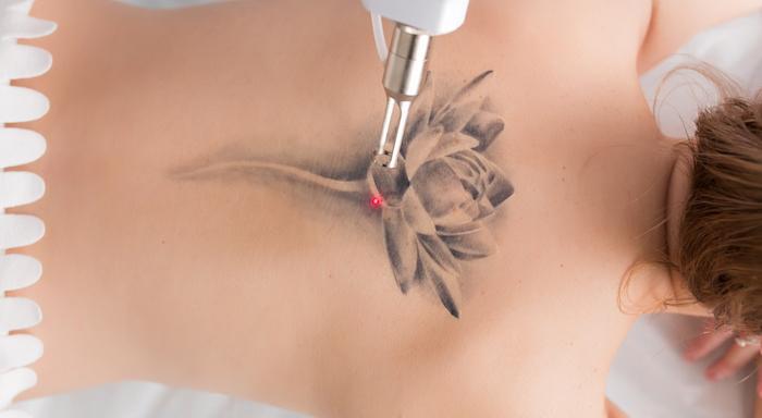 I Regret My Tattoo: Can You Help?