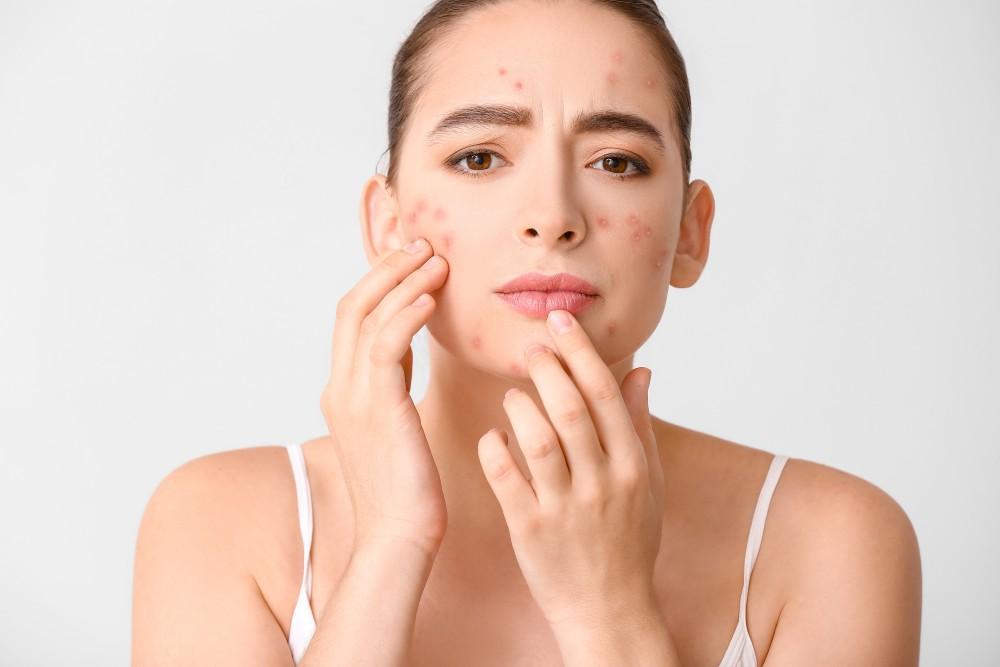 7 Signs Your Skin Needs Professional Attention Now