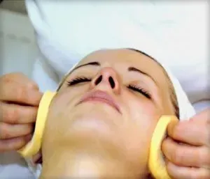 Chemical Peel