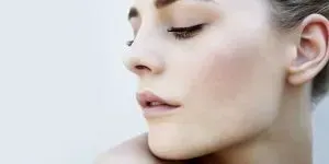 Treating Acne Scars
