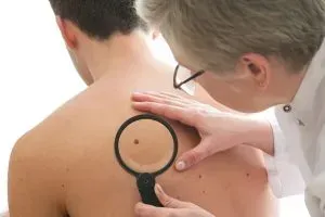 Skin Cancer Treatments