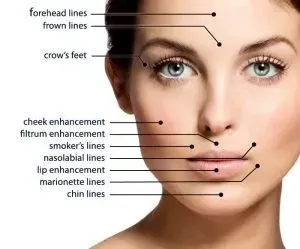 Why Use Dermal Fillers?