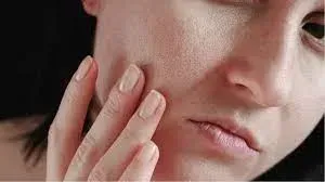 5 Dermatology Tips For Dry Skin