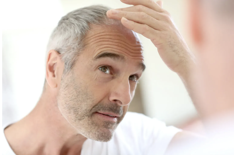 Hair Loss