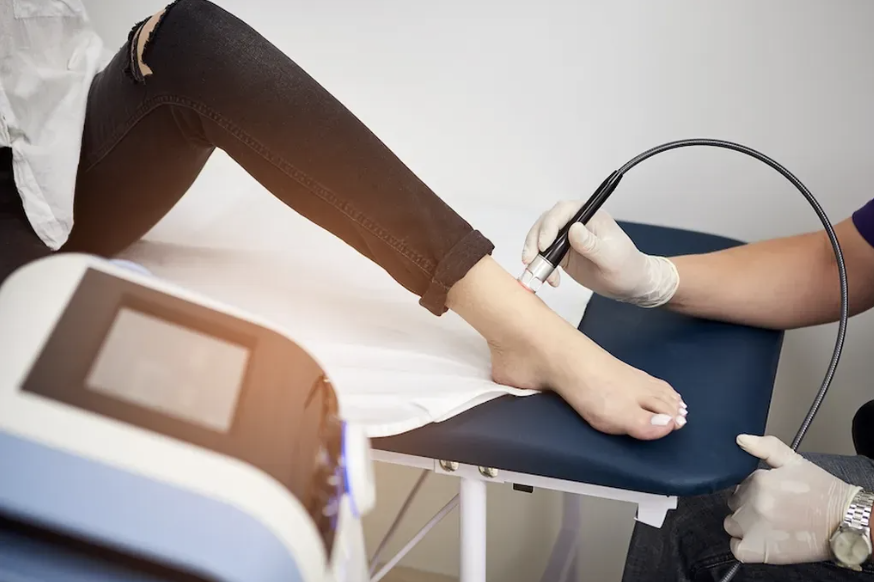 CO2 Laser Resurfacing